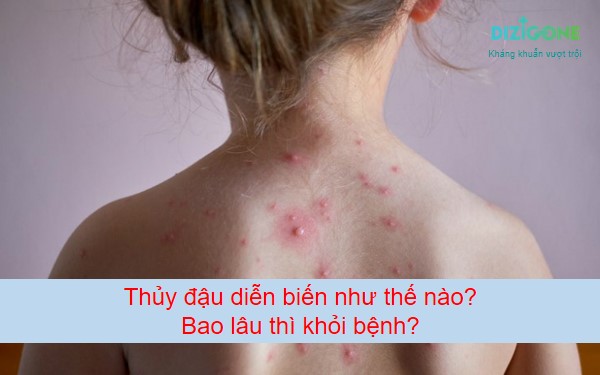 Chữa Giang Mai Ở Hà Tĩnh Khoảng Bao Lâu Thì Khỏi 3