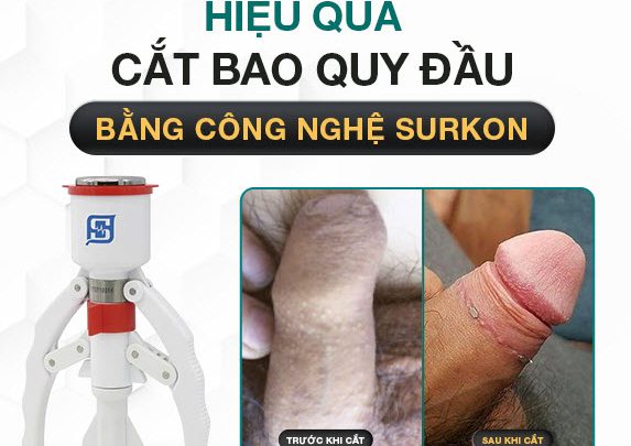 Chưa Cắt Bao Quy Đầu Quan Hệ Có Thai Không? Khi Nào Nên Cắt BQĐ? 2