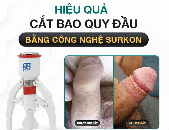 Chưa Cắt Bao Quy Đầu Quan Hệ Có Thai Không? Khi Nào Nên Cắt BQĐ? 2