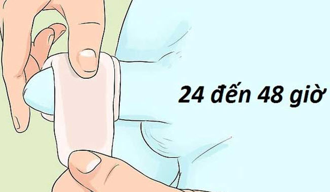 Cắt Bao Quy Đầu Bao Lâu Thì Tháo Băng? Nên Tự Tháo Hay Nhờ Bác Sĩ?