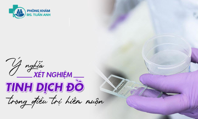 Xét Nghiệm Tinh Dịch Đồ Cần Chuẩn Bị Những Gì? 3