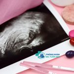 Hiệu Quả Của Đông Y Trong Điều Trị Hiếm Muộn Nam